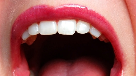 WHO zaleca: zmniejszenie o połowę spożycie cukru pomoże w zwalczeniu próchnicy zębów